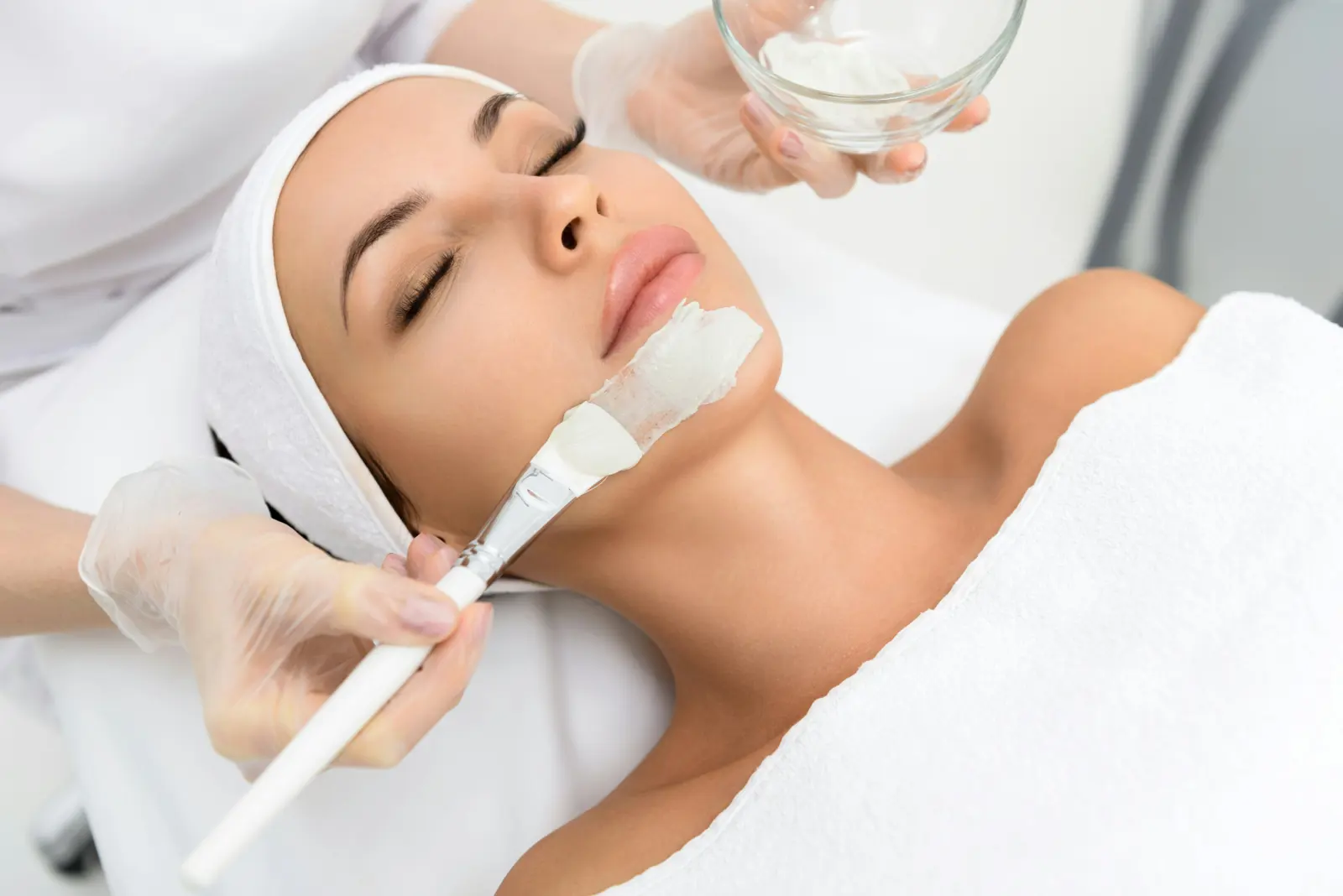 Chemical peels service image
