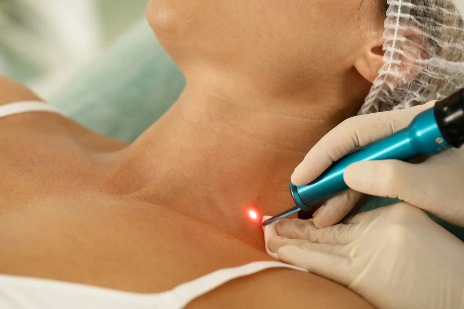 Laser/IPL service image
