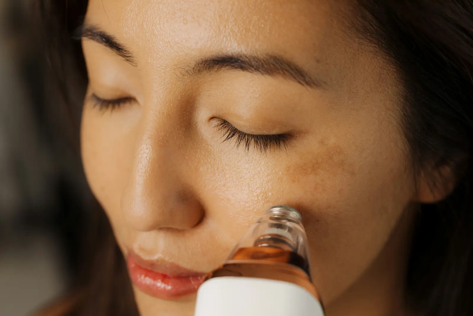 Microneedling service image
